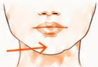 Chin / Mentalis