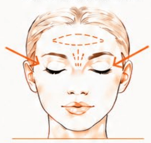Full Upper Face